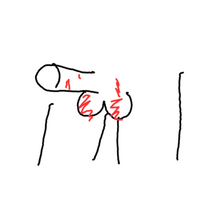 汚い絵で申し訳ないのですが赤い部分と肛門周りが痒いのです 玉袋の方は皮 Yahoo 知恵袋