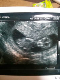 妊娠4ヶ月です 性別を知りたくてたまりません 噂とかでもいいので 知れ Yahoo 知恵袋