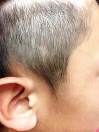 炭酸飲んだ後のゲップは鼻が痛くなりますよね 僕も痛くなります Yahoo 知恵袋