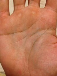 手相の質問です右手の知能線と感情線の間に一本線がありますいろんな手相の Yahoo 知恵袋