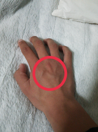 て 痛い 指 の 血管 が 腫れ 血管炎（血管炎症候群）とは？原因や症状、検査方法について