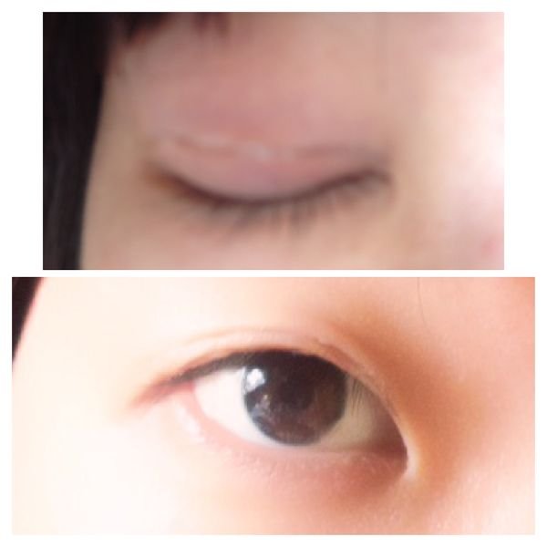 どうしたら絆創膏で綺麗な二重が作れるんですか コツを教えてください Yahoo 知恵袋