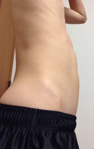 中学生男子です お腹がぽっこりしていて 去年プールの時に恥ずかし Yahoo 知恵袋
