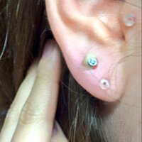 ピアスが膿んで痛いです 膿んだ理由は開けて二週間ほど経つのですがも Yahoo 知恵袋