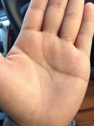 この手相どうですか 右下にあるバッテンの線と中指の下に伸びて Yahoo 知恵袋