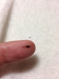 枕元に黒い小さな塊があったのですが これはなんですか Yahoo 知恵袋