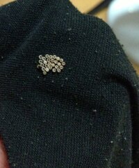 これはなんの卵ですか 干した後の服についてました 硬くてすごく Yahoo 知恵袋
