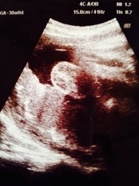 現在 臨月に入ったばかりの妊婦です 今までずっと割れ目が見えたり Yahoo 知恵袋