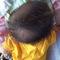 赤ちゃんの頭の形 写真有り 生後3ヶ月の男児です 産まれた時から Yahoo 知恵袋