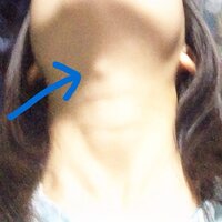 こんばんは 高校生です最近喉が痛いです女子なのに喉仏のようなものがあり Yahoo 知恵袋