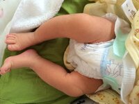 股関節脱臼と赤ちゃんの扱いについて ４ヶ月健診で股関節の開きが悪いとのこ Yahoo 知恵袋