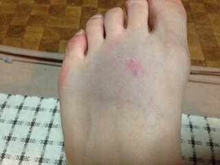 50 ダンベル 足に落とした ダンベル 足に落とした Gambarsaepnr