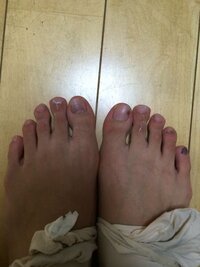 トウシューズで立ったときに 親指が痛いんですけど原因は何です Yahoo 知恵袋