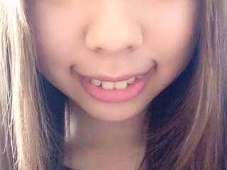 私は出っ歯です 写真の通り 綺麗に笑うことが出来ません Yahoo 知恵袋