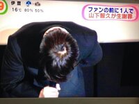 これは29歳の山下智久さんのつむじです はげていますか はげてま Yahoo 知恵袋