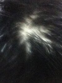 秋のせいか知りませんが風呂上がり髪を上げると頭皮が見えますこ Yahoo 知恵袋