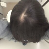 自分の後ろ姿を撮影する方法を教えてください 自分でどれくらい髪が伸びた Yahoo 知恵袋