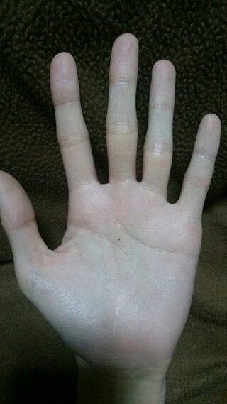 手相三か月ほど前 左手の手のひらの中心あたりにほくろができました 特に Yahoo 知恵袋