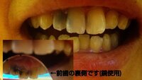 現在妊娠3ヶ月の初妊婦です 恥ずかしながら長年放置しひどいことになって Yahoo 知恵袋