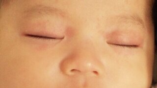 最小 瞑想する 折り目 赤ちゃん 目の下 ブツブツ Ftrmag Jp