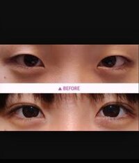 私は一重で目が小さいのがコンプレックスです 高校に入って2 Yahoo 知恵袋