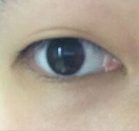 私の目は 両目の目頭にピンクの粘膜 のようなものが見えます 小さい頃に目をこ Yahoo 知恵袋