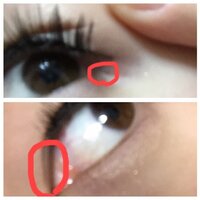 目頭切開ラインが 目やにになったり 丸く滲んだりしてすぐ駄目になってしまいま Yahoo 知恵袋