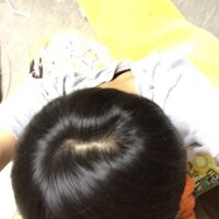 これって禿げですか つむじ が横に広がって いる感じで Yahoo 知恵袋