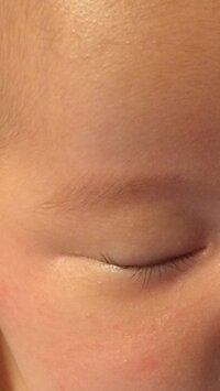 子供 生後3ヶ月 のまつ毛についてなんですが 両目とも 目尻 Yahoo 知恵袋