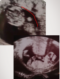 妊娠29週の胎児の推定体重今日 29w3dの健診に行きました そこで推定体重 Yahoo 知恵袋