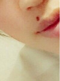 口の上にホクロがあります こういうのって 汚いですよね こんにち Yahoo 知恵袋