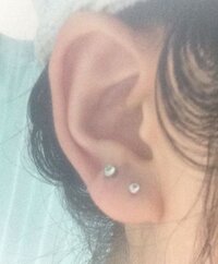 ピアスの痛みはどれくらい続くものでしょうか 一週間前にピアッ Yahoo 知恵袋
