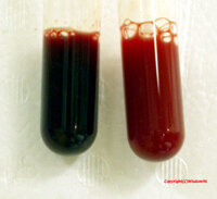 鮮赤色と鮮紅色の違いはなんですか 教えてください お願いします 鮮紅色 Yahoo 知恵袋