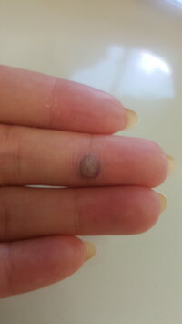 半年前から だんだん肥大した出来物一見 魚の目 皮膚科受診したら いぼ Yahoo 知恵袋