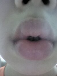 高校生女です 顔が細すぎて悩んでいます 顔の横幅がとてもせまいので頬を太らせた Yahoo 知恵袋