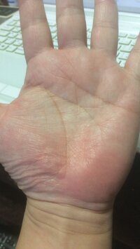 ５２歳男性です 両手にm字の手相があるのですがどなたか手相占 Yahoo 知恵袋