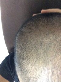 私は俗に言う全スカの男子高校生です 今まで猫っ毛で細く柔らか Yahoo 知恵袋