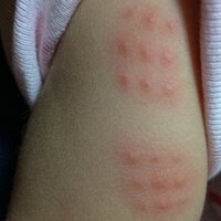 赤ちゃんの骨が鳴ります ５ヶ月の男の子のママです 最近 子供を抱っこしょうと Yahoo 知恵袋