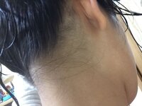 髪の毛について 襟足の毛がとても汚いです 普段は画像のようにポニーテー Yahoo 知恵袋
