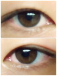 これは眼瞼下垂とみなされますか 実際は奥二重と分からない一重です Yahoo 知恵袋