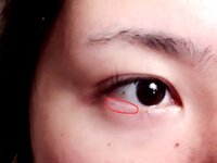 下まぶたのフチの白い部分が一部赤くなります 画像参照 赤みは 全く気 Yahoo 知恵袋