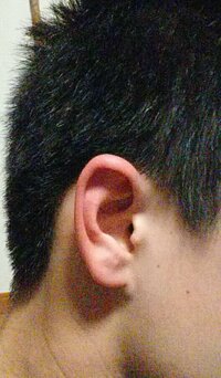僕は耳が小さいです いわゆる朝鮮耳と言われる耳ではないかと心 Yahoo 知恵袋
