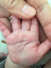 生後5ヶ月の赤ちゃんの手相について質問です 知能線が途中切れ Yahoo 知恵袋