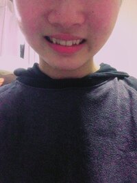 高校生男子です 自分は笑ったとき写真のように口角が左右非対称に Yahoo 知恵袋