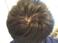 つむじのところどうすれば治りますか もともと右に流す感じなん Yahoo 知恵袋