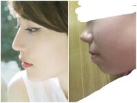 これってダイエットだけでしょうか 痩せたらこんなに横顔に変 Yahoo 知恵袋