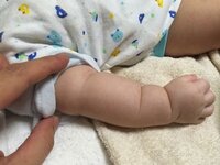 ２ヶ月の赤ちゃんの腕について質問です 写真では 右腕の肘の部分に Yahoo 知恵袋