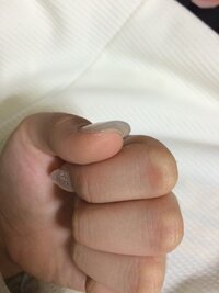 このまえ初めてスカルプしました ですが 3日ほどで親指の自爪とスカルプ Yahoo 知恵袋