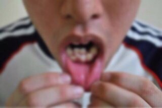 歯並びが この方の写真以上に悪いです ある芸人の方の写 Yahoo 知恵袋