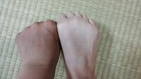 写真あり 肌を白くしたいです 腕や 手 ふくらはぎなどが 黒くなって Yahoo 知恵袋